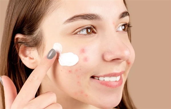 为什么有人总管不住手去挤痘痘(图4) 为什么有人总管不住手去挤痘痘