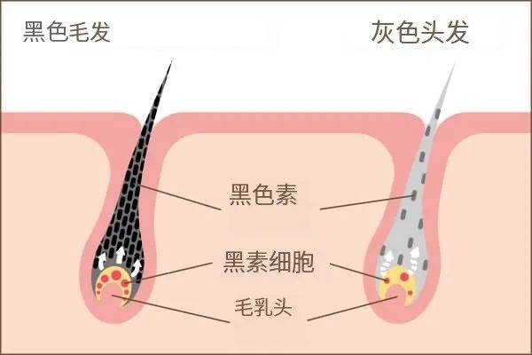 除了染发 头发白了还能变黑吗：医生给的答案出乎意料