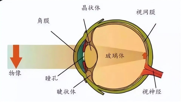 近视的人老之后：是视力逐渐变好 还是同时老花眼