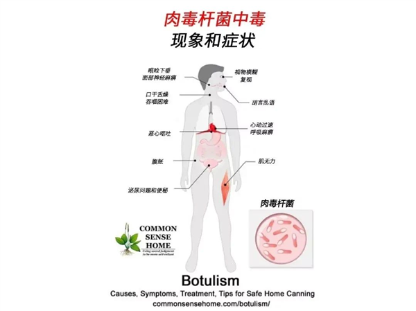 400克可以杀死世界上所有人！疾控部门紧急提醒