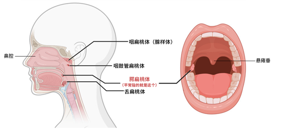 慎入！口腔内长出“玉米粒” 捏扁了还臭臭的 到底是啥