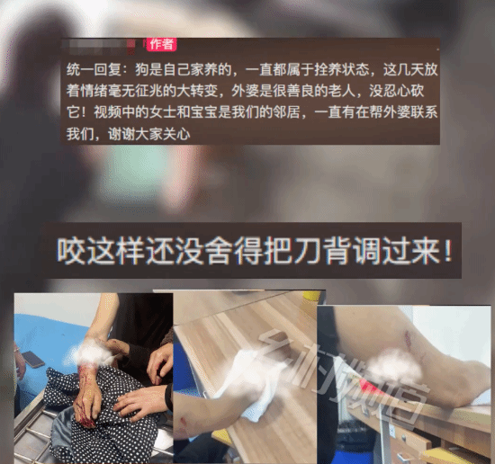 老人手臂被家养狗撕咬：手中握刀不舍得砍 网友唏嘘不已