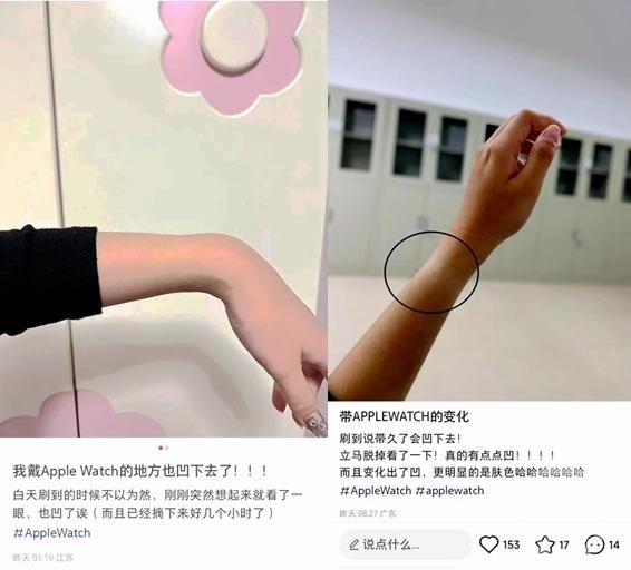多人称戴苹果手表“手凹了” 网友看完直呼这也可以:客户火速回应